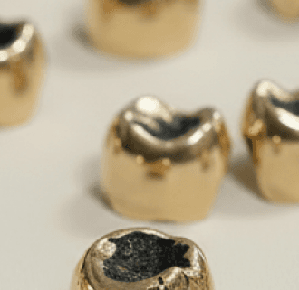 Zahngold Ankaufsportfolio.png