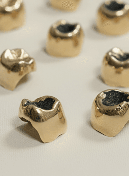 zahngold portfolio-2.png