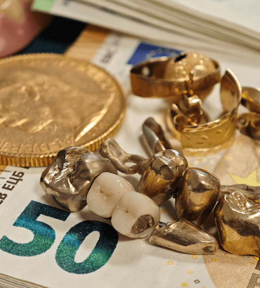 Zahngold Ankauf in Rendsburg bei Johannsson Goldankauf - Zahngold mit Bargeld